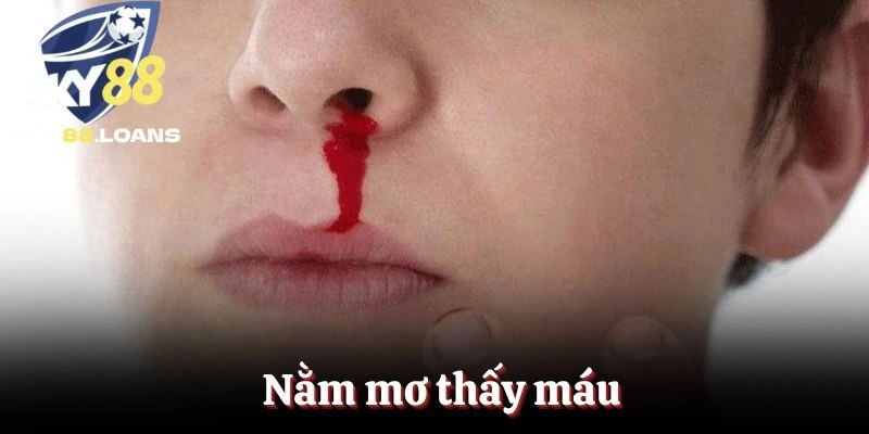 Nằm Mơ Thấy Máu – Ý Nghĩa, Điềm Báo Và Con Số May Mắn